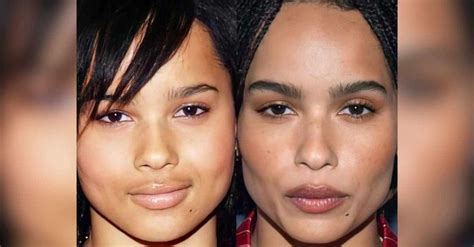 zoe kravitz plastic surgery|Zoe Kravitz Before and After Plastic Surgery